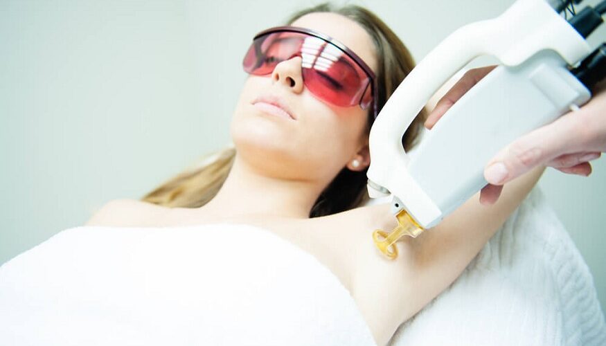 IPL And Laser Hair Removal