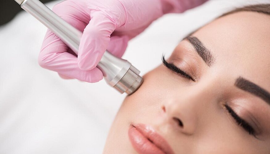 Whats is Microdermabrasion