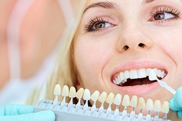 Are dental veneers worth it?