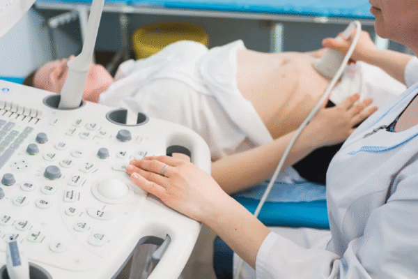 What are the First Signs of PCOS? (7 Early Signs)