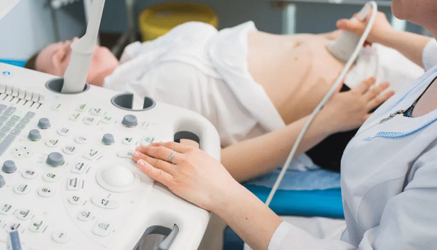 First Signs of PCOS