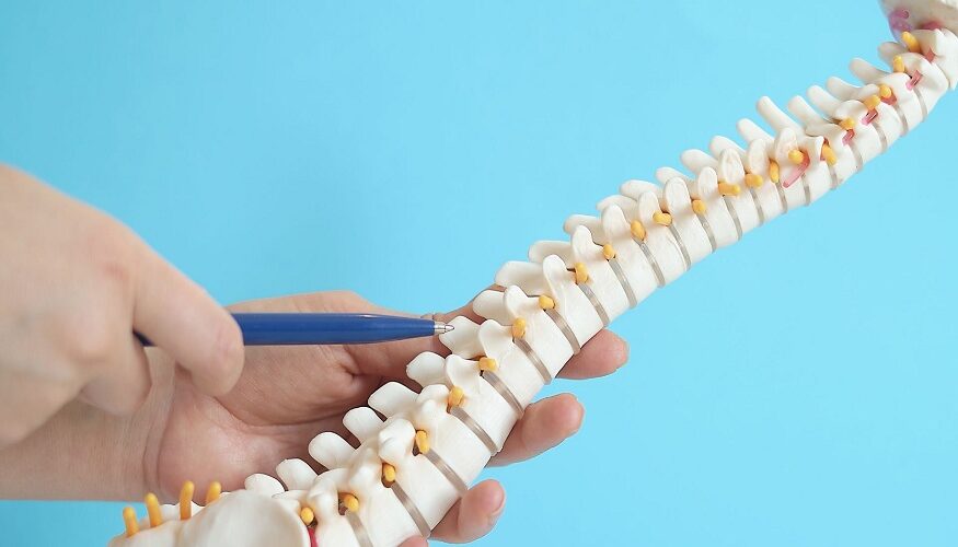 Outcomes in Spinal Fusion