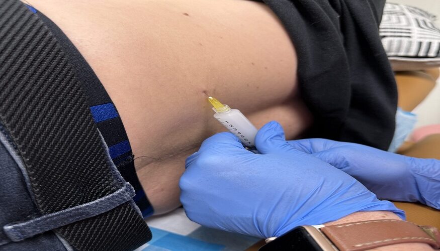 Testosterone Replacement Therapy