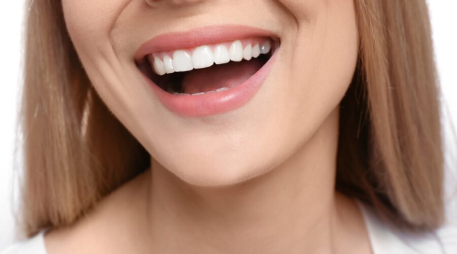 Preserving the Natural Smile